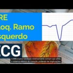 Aorta Ateromatosa: Significado e Implicações