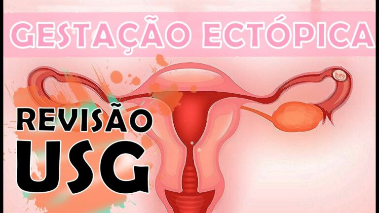 Explorando a Cavidade Uterina Virtual: Inovações e Benefícios