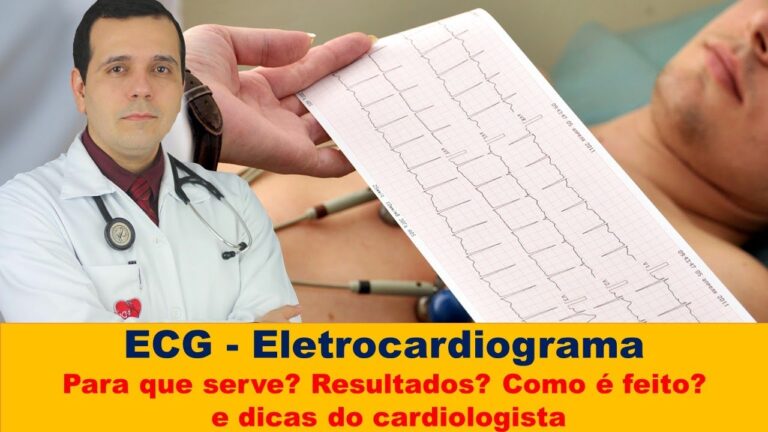 Entendendo o CID para Eletrocardiograma
