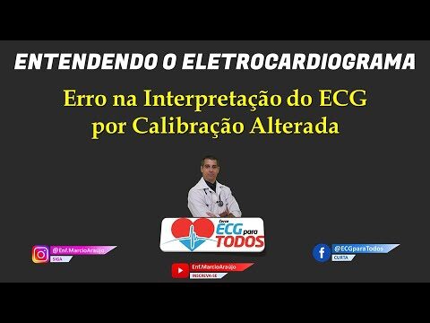 ECG 25mm/s e 10mm/mV: Entenda o que é Normal