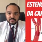 Test&iacute;culo n&atilde;o Descido: Causas e Tratamentos