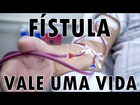 Imagens de Fístula para Hemodiálise: Guia Visual e Informativo