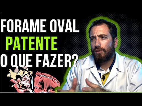 Forame Oval Pervio: Causas, Sintomas e Tratamentos