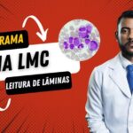 Entenda os Complexos Ventriculares Prematuros