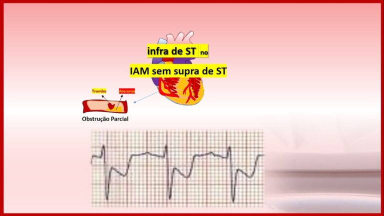 Otimizando IAM com Infraestrutura de ST