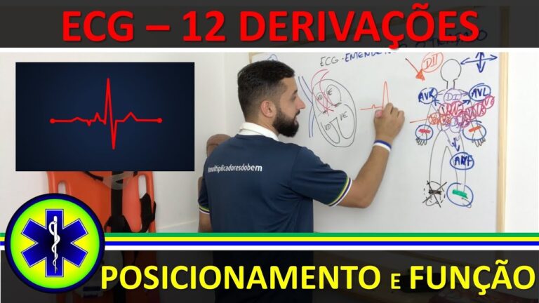 Entendendo as Derivações ECG e o Papel dos Eletrodos