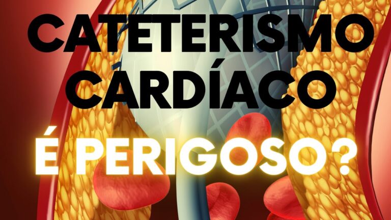 Valor do Cateterismo: Importância e Benefícios na Saúde Cardiovascular ...