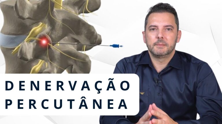Denervação Percutânea: Avanços e Benefícios na Medicina Moderna