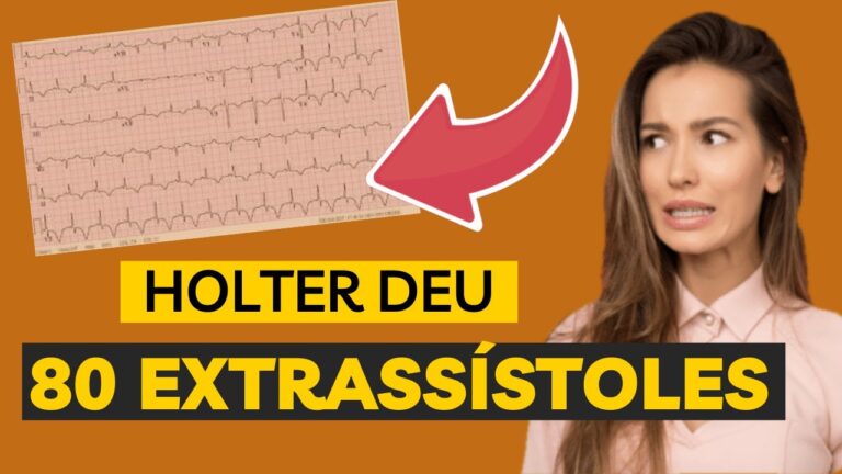 Análise do Resultado do Holter em Arritmias Ventriculares
