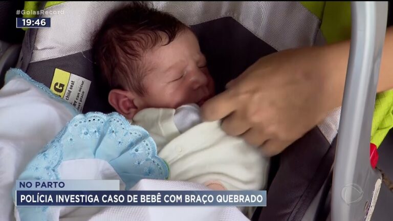 Cuidados Essenciais para Beb&ecirc;s com Bra&ccedil;o Quebrado