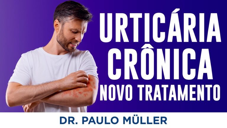 Anti-histamínicos Eficazes para Urticária