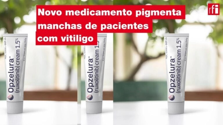 Oxsoralen: Indicações e Precauções