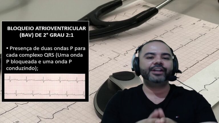 BAV 2 Grau: Entendendo a Classificação e Suas Implicações