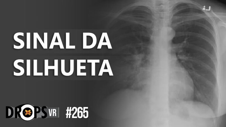 Entendendo o Sinal de Roesler: Aplicações e Importância na Engenharia