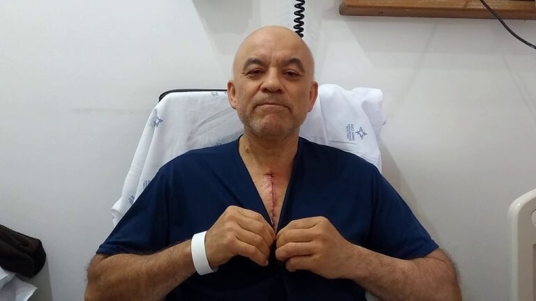 Minimizando a Cicatriz na Cirurgia de Ponte de Safena
