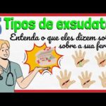 Cirurgia de Tendão na Mão: Tudo o Que Você Precisa Saber