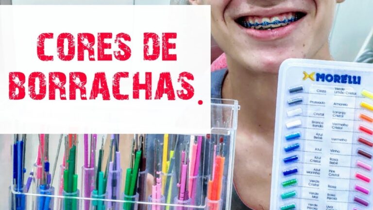 Guia Completo sobre Tabela de Borracha de Aparelho