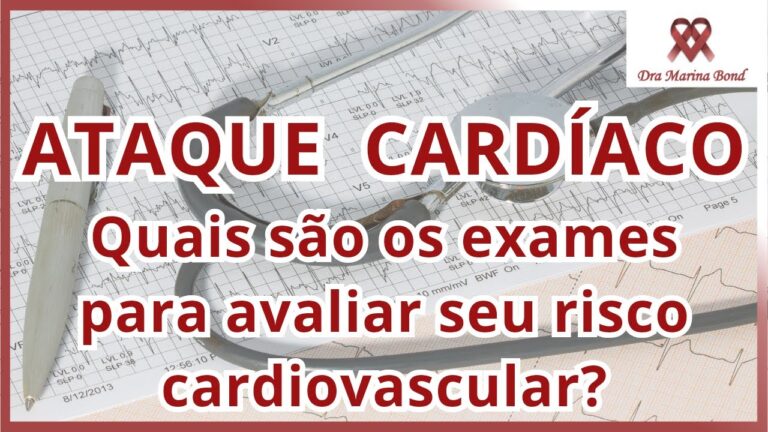 Exames Card&iacute;acos Laboratoriais: Import&acirc;ncia e Interpreta&ccedil;&atilde;o