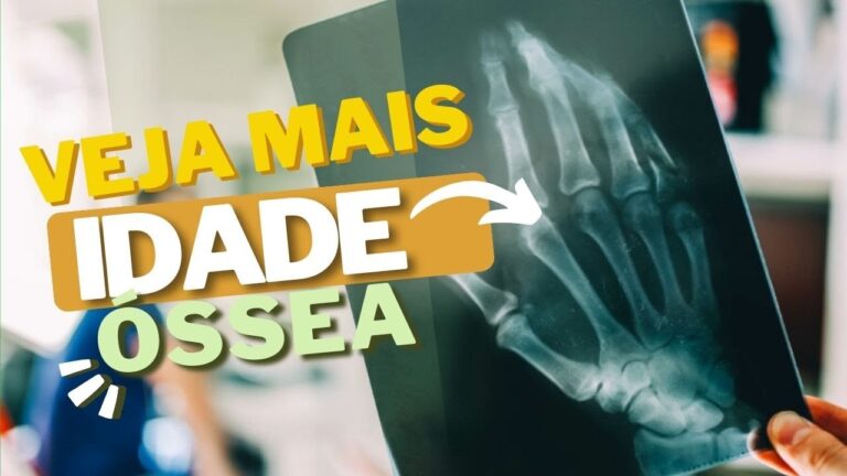 Interpretação da Idade Óssea em Exames de RX