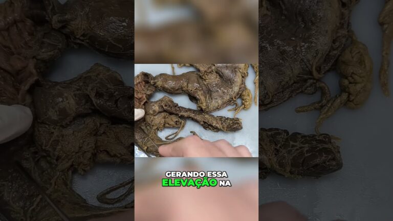 Estruturas e Funções da Papila Maior e Menor do Duodeno
