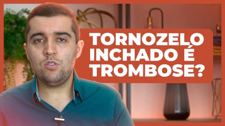 Tor&ccedil;&atilde;o no Tornozelo: Risco de Embolia em Foco