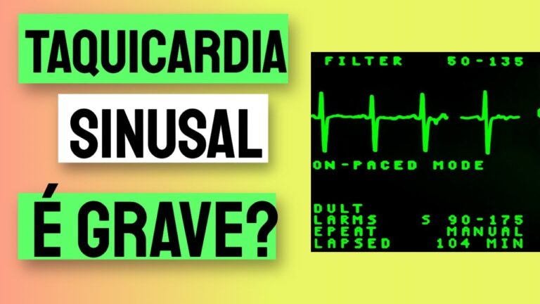 Entendendo a Taquicardia Sinusal: Causas e Significados