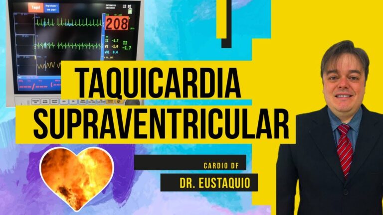 Taquicardia Supraventricular: Entenda os Riscos e Tratamentos