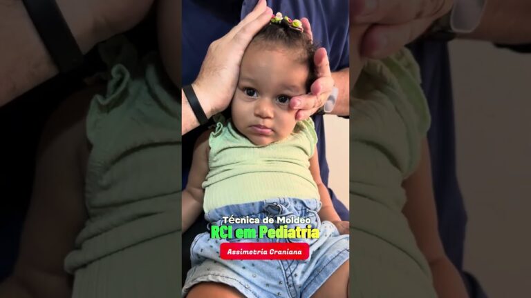 A Gravidade da Assimetria Craniana: Causas e Implicações