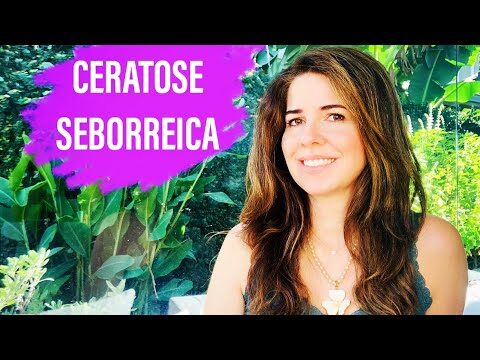 Entendendo as Ceratoses Seborreicas: Causas e Tratamentos