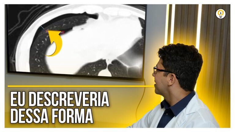 Tomografia no Diagnóstico de Pneumotórax