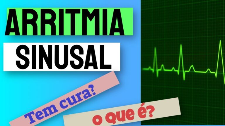 Arritmia Sinusal: Riscos e Cuidados Essenciais