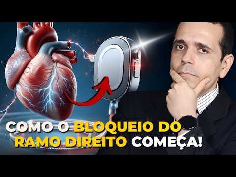 Sintomas do Bloqueio Completo do Ramo Direito