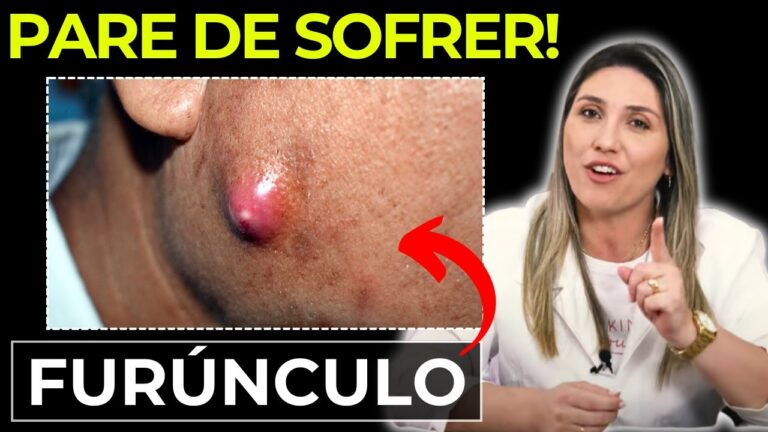 Furacin Pomada: Indicações e Benefícios