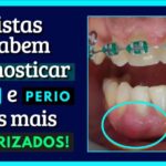 Teste de Visão: Como Saber se Tenho Problemas de Vista