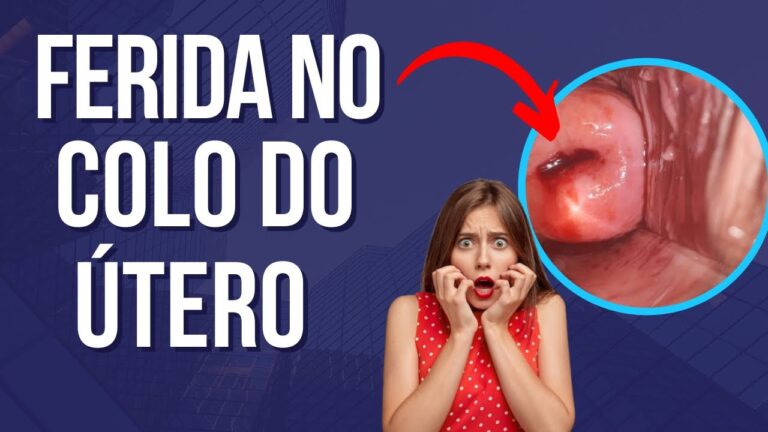 Causas de Feridas no Útero: O Que Você Precisa Saber | Actualizado ...
