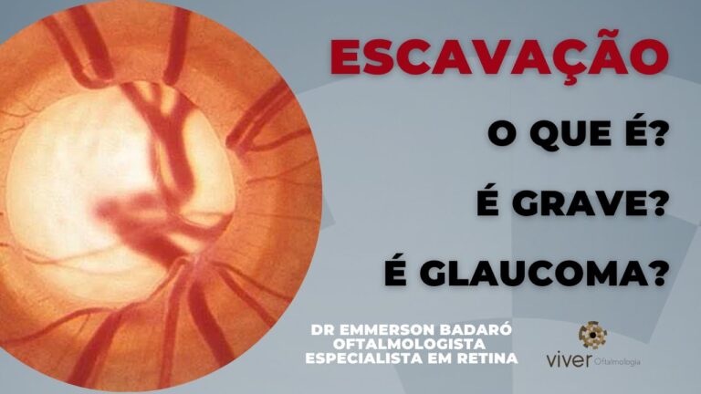Escavação do Nervo Óptico: Implicações e Diagnóstico