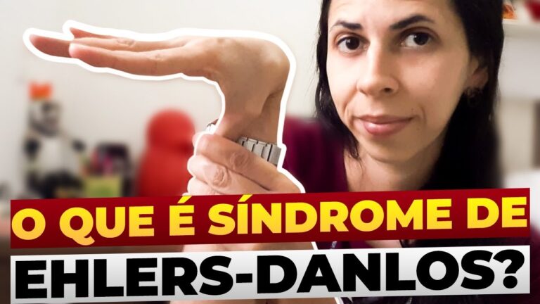 Entendendo o Síndrome de Ehlers-Danlos: Sintomas e Tratamentos