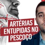 Implante Coclear: Tecnologia e Benefícios