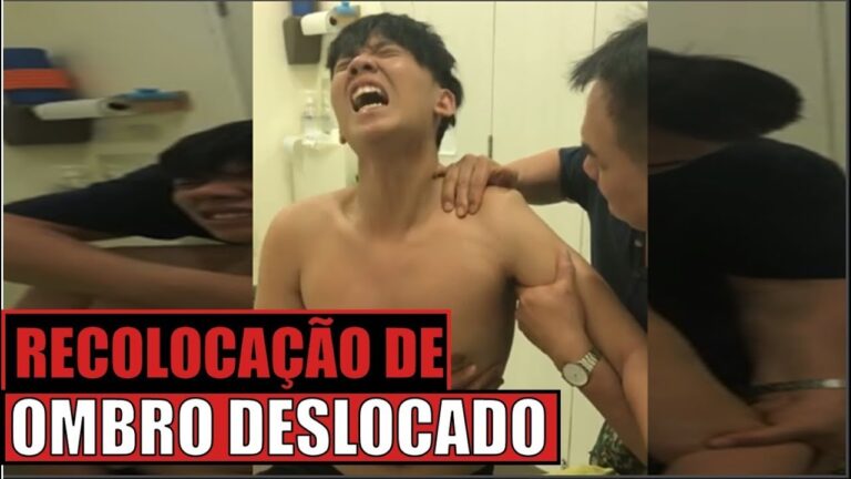 Ombro Deslocado: Retorno Espont&acirc;neo e Cuidados Necess&aacute;rios