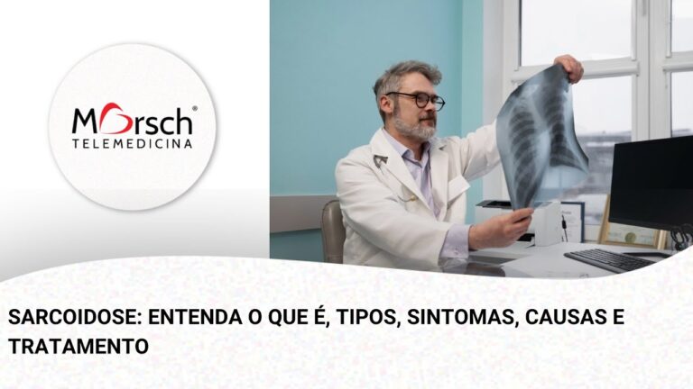 Sarcoidose: Entenda a Gravidade da Doen&ccedil;a