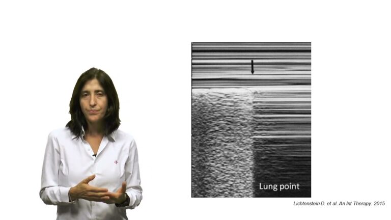 Linhas B no Ultrassom: Entendendo sua Importância e Interpretação