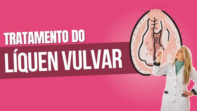 Entendendo o Líquen na Vulva: Causas e Tratamentos