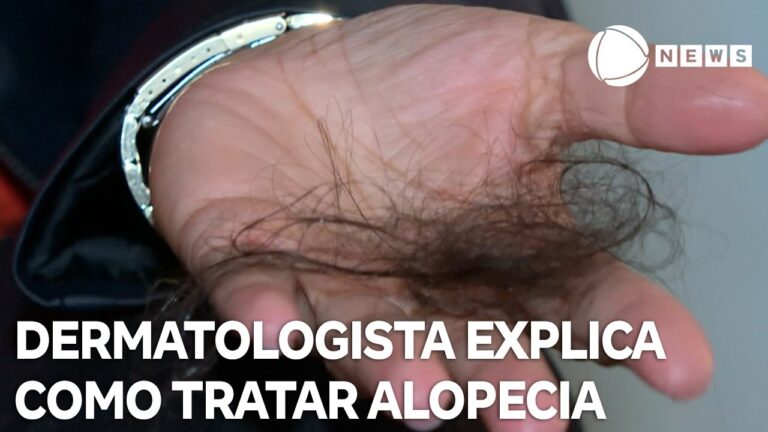 Sintomas da Calvície: Identificação e Prevenção