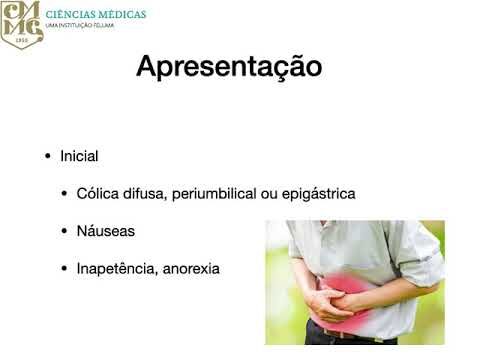 Plastr&atilde;o Apendicular: Fun&ccedil;&otilde;es e Import&acirc;ncia na Anatomia Aqu&aacute;tica
