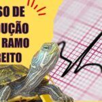 Cirurgia de Tendão na Mão: Tudo o Que Você Precisa Saber