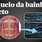 Benef&iacute;cios do Gengibre para a Pr&oacute;stata: O que Voc&ecirc; Precisa Saber