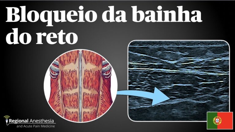 Entendendo a Bainha do Reto Abdominal: Função e Importância