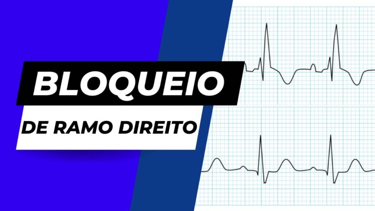 Orelha de Coelho: Entendendo o ECG e suas Implicações