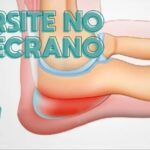 Proteína na Urina: Causas e Tratamentos