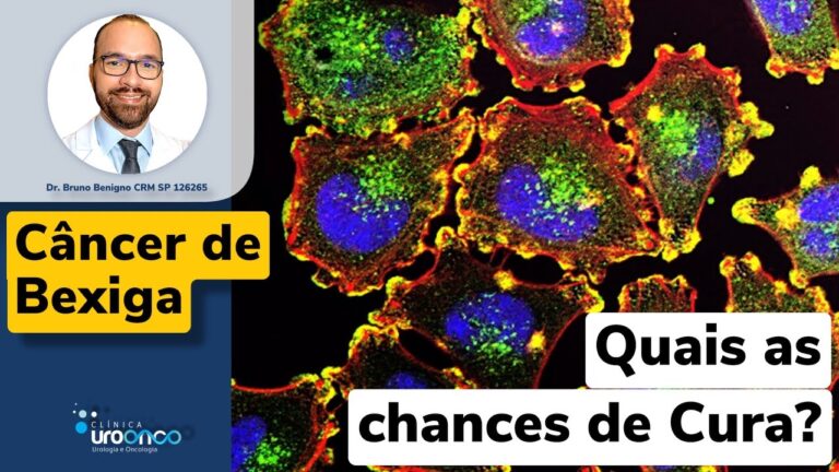 Abordagem e Tratamento do Tumor de 5 cm na Bexiga